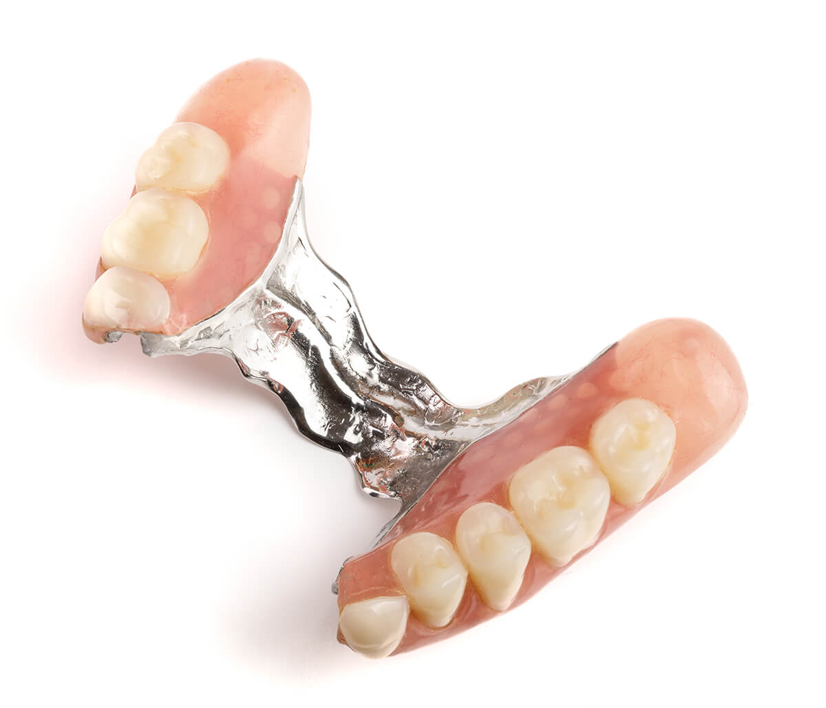Flexible Partial Dentures in Burlington Ontario Area