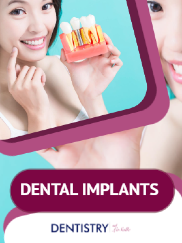 Bridging the Gap with Dental Implants
